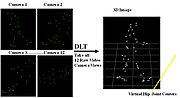 Thumbnail for Gait analysis