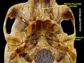 Mandibular fossa