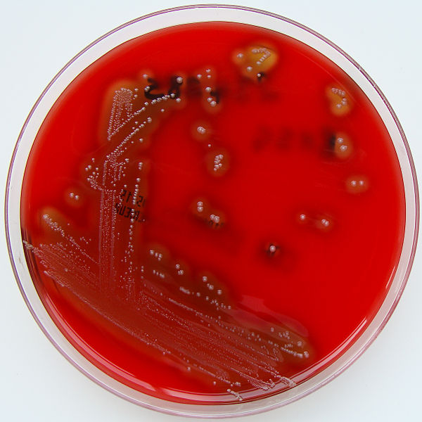 File:Streptococcus pyogenes (Lancefield Group A) on Columbia Horse Blood Agar.jpg