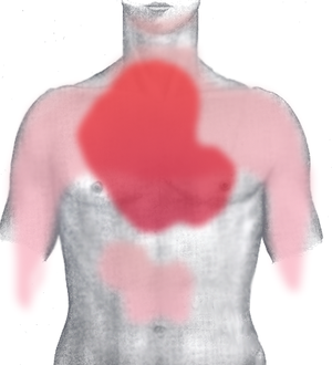 Chest Pain in Angina (front)