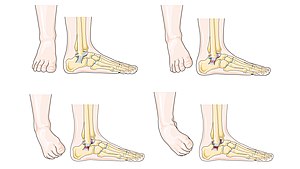 Why is ankle extension called plantar flexion?