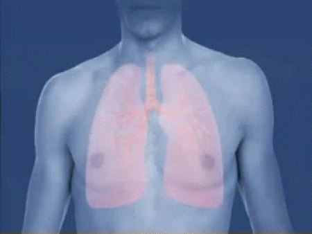 Tập_tin:Asthma_attack-airway_(bronchiole)_constriction-animated.gif