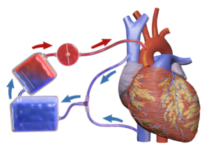 Illustration of one typical way that a heart-lung machine may be connected to the veins and arteries near the heart. The three implements on the left represent (from top to bottom) the pump, the oxygenator, and the reservoir. Blausen 0468 Heart-Lung Machine.png