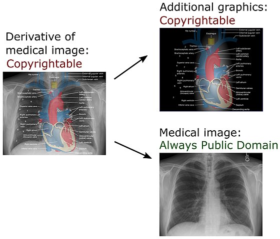 In a derivative of a medical image created in the U.S., added annotations and explanations may be copyrightable, but the medical image itself remains public domain.