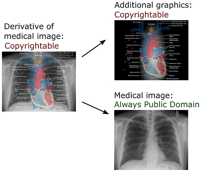 File:Derivative of medical imaging.jpg
