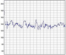 Heart rate - Wikipedia