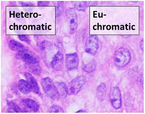 Microscopy of heterochromatic versus euchromatic nuclei (H&E stain).