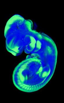 Soubor: Loss-of-the-BMP-Antagonist-SMOC-1-Causes-Ophthalmo-Acromelic- (Waardenburg-Anophthalmia) -Syndrome-in-pgen.1002114.s005.ogv