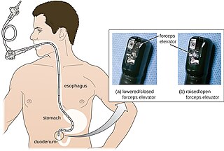 Fortune Salaire Mensuel de Endoscopie Digestive Combien gagne t il d argent ? 10 000,00 euros mensuels