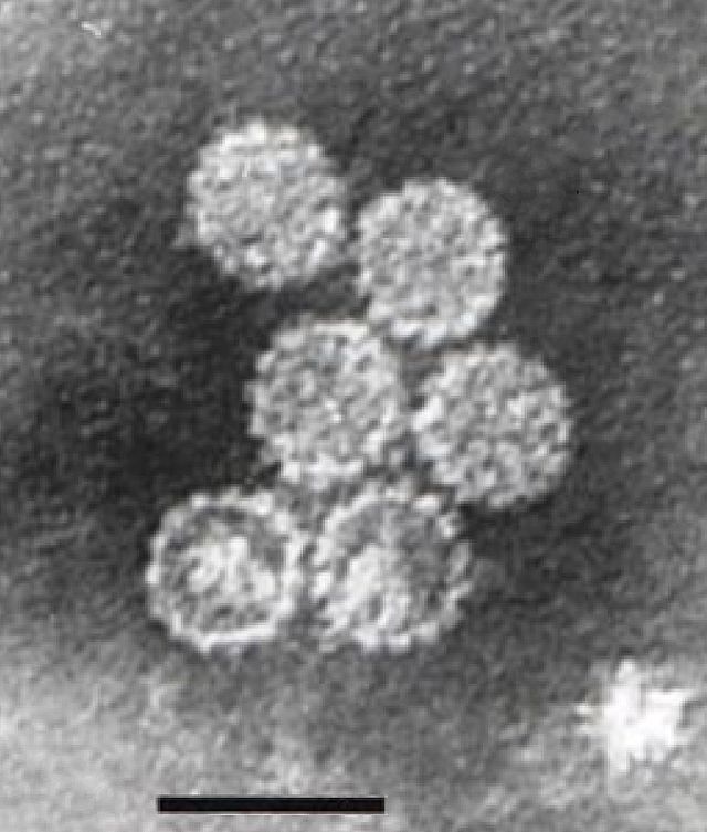 Papilloma virus humans. What is HPV? paraziți în corpul uman