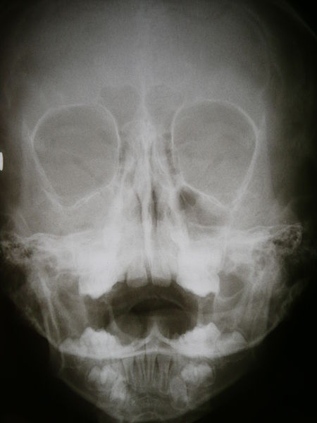 File:Radiology 1300312.JPG