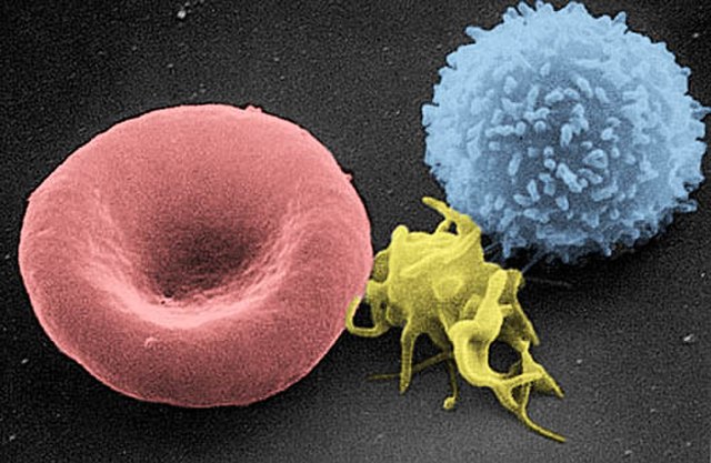 A scanning electron microscope (SEM) image of a normal red blood cell (left), a platelet (middle), and a white blood cell (right)