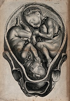 A cross-section of a pregnant uterus containing twins. Engra Wellcome V0014950.jpg
