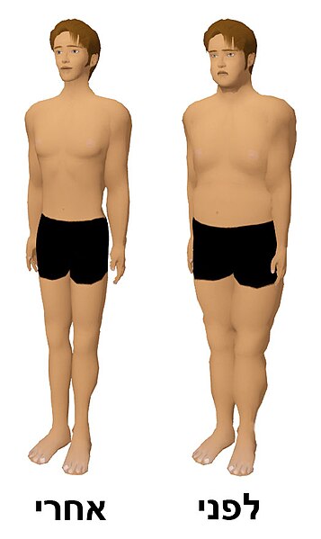 File:Before and after comparison of weight loss (Hebrew version).jpg