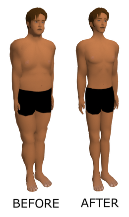 Before and after comparison of weight loss 2015-06-25.png