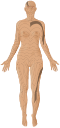 Blaschko's lines, patterns female front 3d-shaded