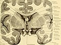 Diseases of the nervous system (1910) (14792871073).jpg