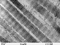 Slika tankog presjeka kroz vezivno tkivo pluća sisavca.Veliko povećanje prkazuje vlakna kolagena tip I (snimano pomoću transmisijskog elektronskog mikroskopa).