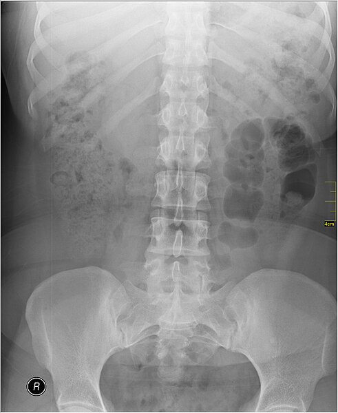 File:Medical X-Ray imaging VQB07 nevit.jpg