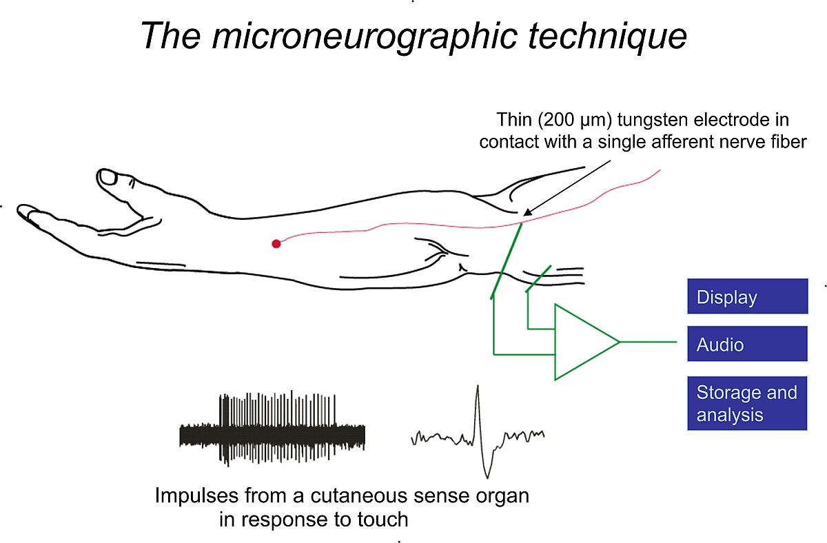 a Neurophysiological mechanisms of electrical stimulation of muscles