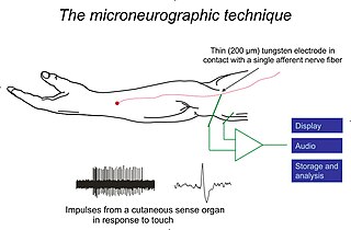 <span class="mw-page-title-main">Microneurography</span>