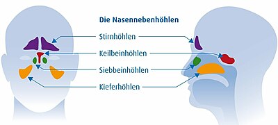 Ortenau Klinikum Nasennebenhöhlen11.jpg