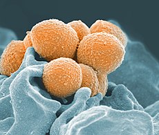 Scanning electron microscope image of Group A Streptococcus orange during phagocytic interaction with a human neutrophil teal
