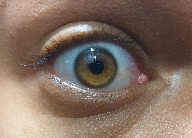 File:Amber-colored-eye.jpg