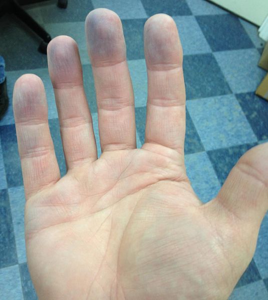 File:Blue finger tips 3.jpg