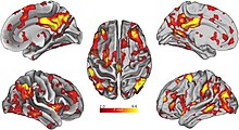 Distributed functional brain network associated with divergent thinking Distributed network of voxel clusters associated with divergent thinking.jpg