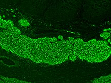 Immunofluorescence staining pattern of endomysial antibodies on a monkey oesophagus tissue sample ENDOMYSIAL ANTIBODIES.jpg