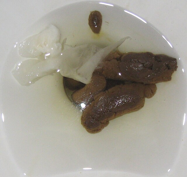 poop toilet bowl