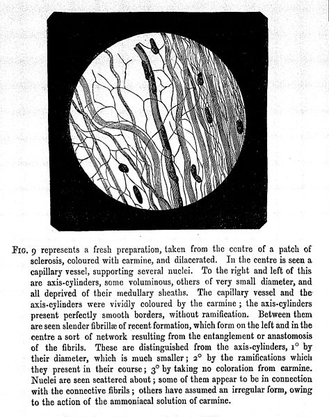 File:J.M. Charcot, Lectures on the diseases of th Wellcome L0029868.jpg