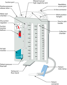 Chest tube drainage system diagram, with parts labeled in Labelled chest tube drainage system.png