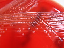Listeria monocytogenes na krevním agaru
