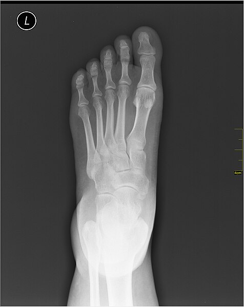 File:Medical X-Ray imaging PRA06 nevit.jpg