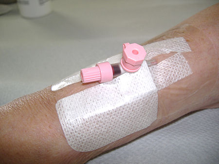 Placement of intravenous cannula 3.jpg