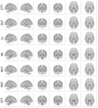 Brainstem