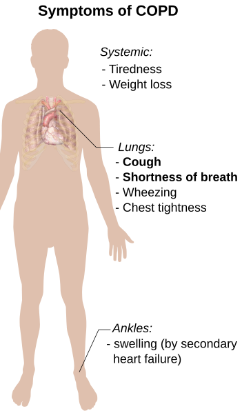 File:Symptoms of COPD.svg