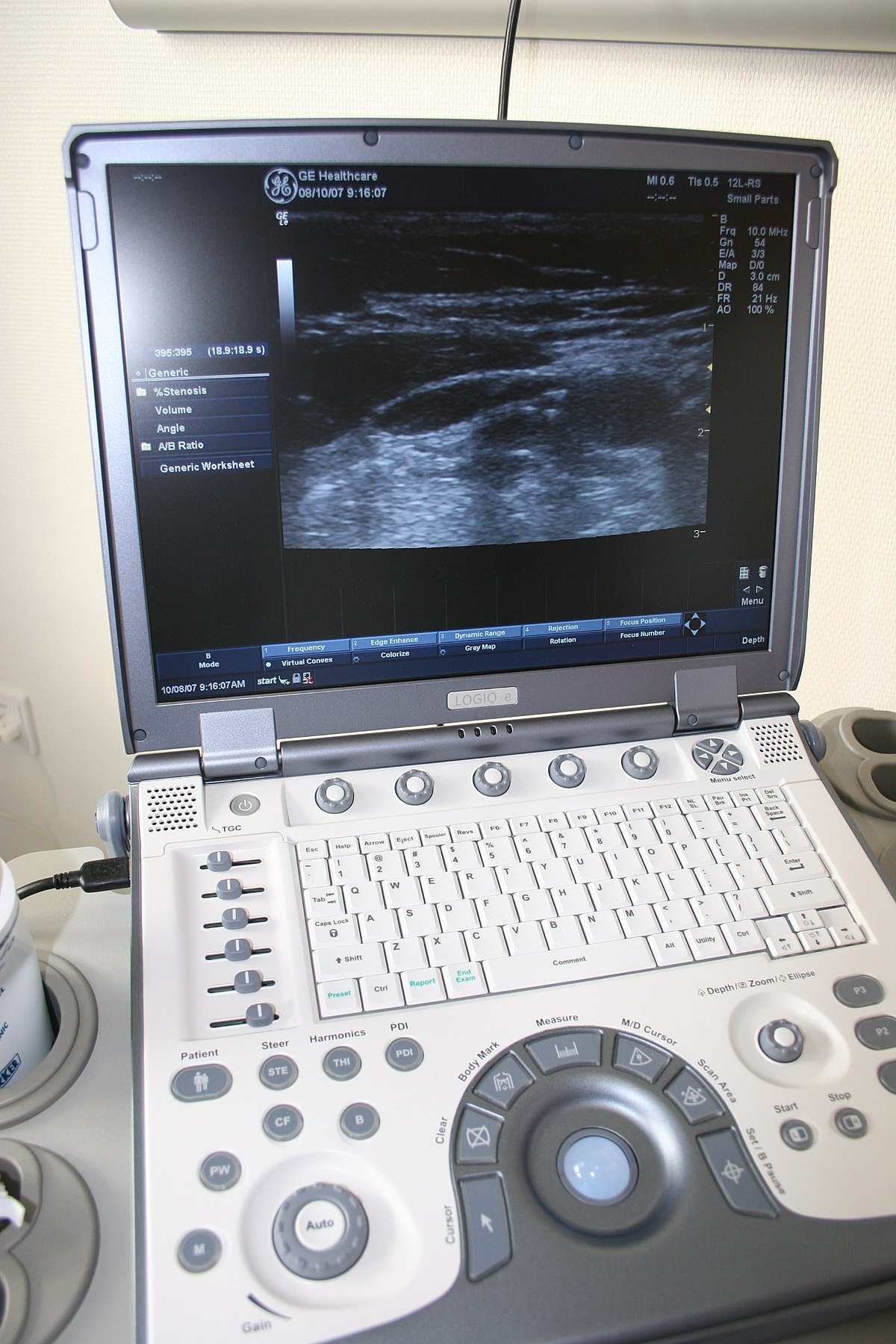Doppler fetal monitor - Wikipedia