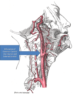The bifurcation of the carotid artery where the carotid body would be located. Gray's Anatomy with markup showing carotid artery bifurcation.png