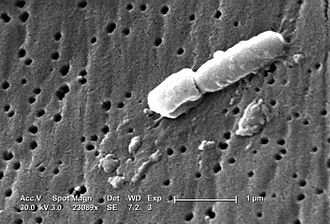 Klebsiella pneumoniae with scale bar Klebsiella-pneumoniae.jpg