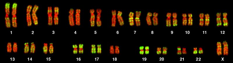 23 זוגות כרומוזומים מתא של אישה (נראים זוג כרומוזומי X). הכרומוזומים נצבעו באמצעות היבירידזציה פלואורסצנטית באתר, תוך שימוש בגלאי לרצפי Alu (בירוק) ובצביעת נגד ל-DNA (באדום). רצפי Alu הם דוגמה נפוצה של DNA זבל.