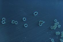"S. enterica" Typhimurium colonies on a Hektoen enteric agar plate