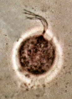 Trichomonas vaginalis phase contrast microscopy.jpg