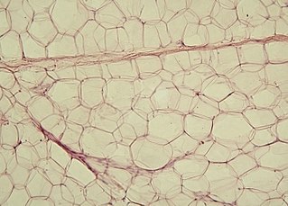 Adipocyte cells that primarily compose adipose tissue, specialized in storing energy as fat