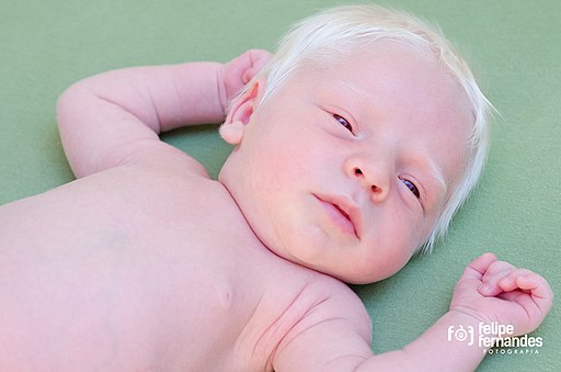 Albino baby by Felipe Fernandes 02