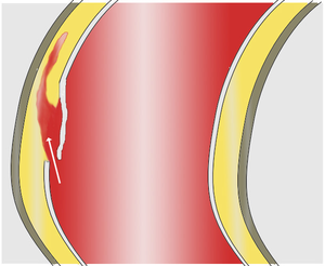 Schema AoDissect 01a.png