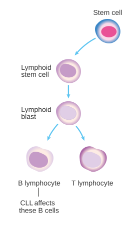 File:Diagram showing the cells CLL afects CRUK 296.svg