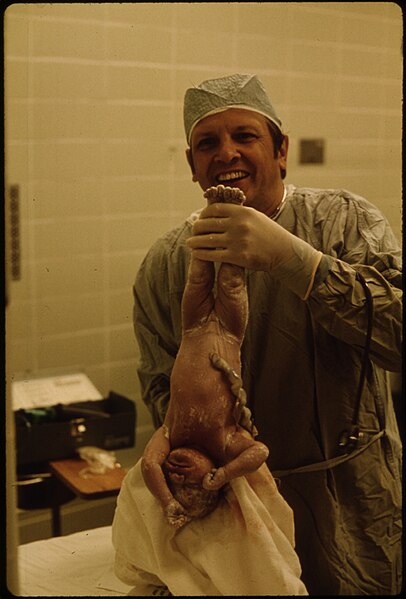 File:Dr. Milton Kaiser, an associate of Dr. Howard Vogel and Dr. Ann Vogel, holds a newborn baby soon after its caesarean... - nara - 558176.jpg